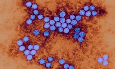 Israel alerta tras detectar primer caso de polio en 33 años.
