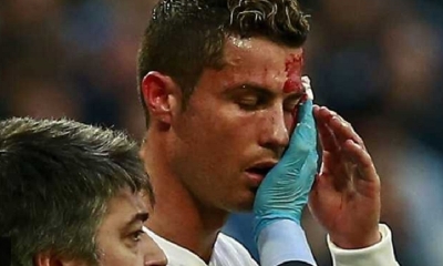 El portugués se presentó a los entrenamientos de su equipo con un ojo morado