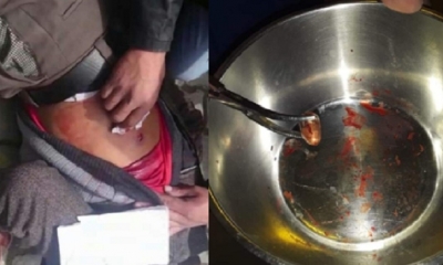 Así le sacaron la bala al difunto/Foto. Kandire 