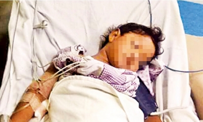 Un micro del servicio público los golpeó por la parte posterior provocando que la niña acabe debajo el motorizado
