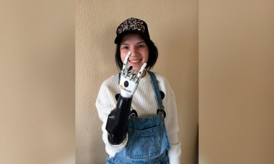 Margarita Grachióva con su nueva prótesis biónica. Foto: RRSS