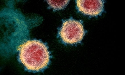 Una micrografía electrónica del virus SARS-CoV-2