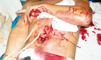 Un joven de 21 años terminó con una apuñalada en el abdomen tras sufrir un asalto la noche del martes