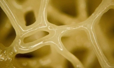 Posible remplazo de cartílagos y otros tejidos biológicos mediante elastómeros cristalinos líquidos (LCE) | Fuente: Universidad de Colorado en Denver