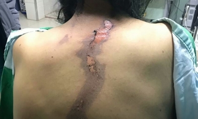 La señora se encontraba escarbando papa en el lugar/Foto. RF