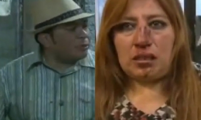 El hombre le provocó heridas de consideración en el rostro/Foto. Kandire
