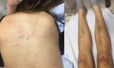 El papá de la víctima asegura que su hija está destruida/Foto. Kandire