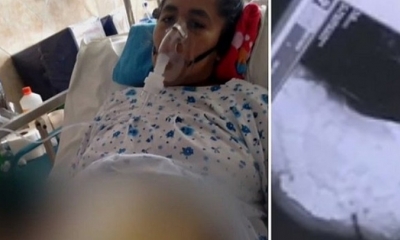 Médicos olvidaron gasa dentro de mujer y ya no pueden ingresar a sala de operaciones