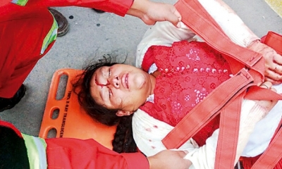 La mujer presenta un corte de consideración en la frente y fue evacuada por personal de Bomberos a un centro hospitalario