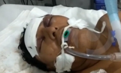 El afectado requiere urgente una cirugía/Foto. Captura de pantalla
