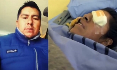 La víctima se recupera de los golpes/Foto. Kandire