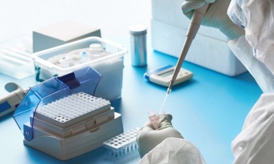  Tests PCR para coronavirus 