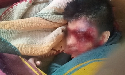 Un joven resultó herido en la intervención policial. Foto/Defensoría del Pueblo