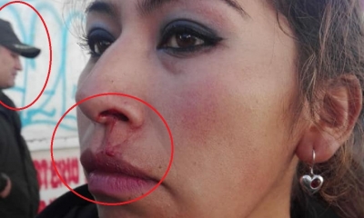 Así quedó la funcionaria municipal de La Paz/Foto. RRSS