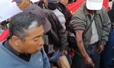 Mostraron las secuelas físicas que padecen.
