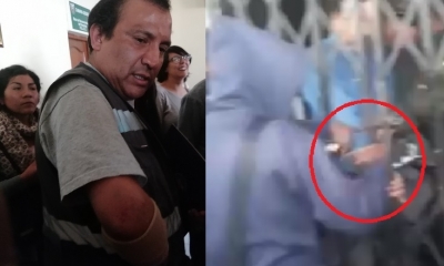 El brazo derecho sufrió agresiones por los estudiantes/Foto. Kandire
