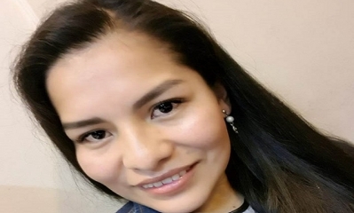 Los golpes que presenta el cráneo de Zulma Vargas Cortez se produjeron antes de su fallecimiento.