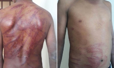 Así quedó el cuerpo del niño/Foto. RRSS