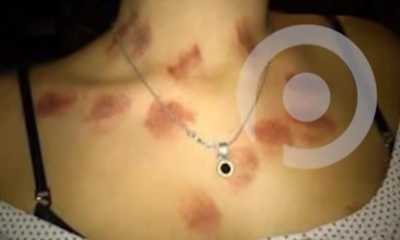 A la víctima le dieron drogas para que quede inconsciente/Foto. Kandire 
