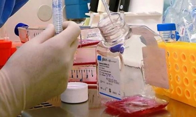 Científicos regeneran grandes heridas con células madre.