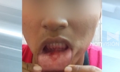La mujer fue agredida delante de su hija de 4 años/Foto. RRSS