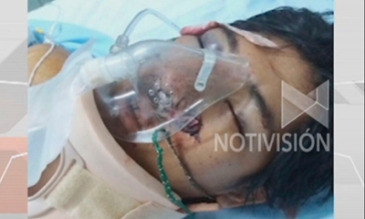 Tienen 22 años y se encuentra internado en la clínica Melendres con un cuadro de traumatismo craneoencefálico y daños en el rostro.