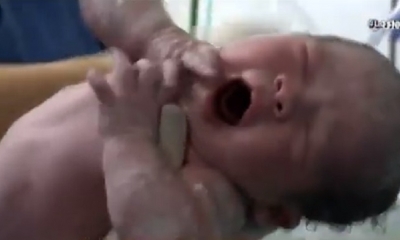La bebé fue sometida a una cesárea, exitosa/Foto. Captura de pantalla 