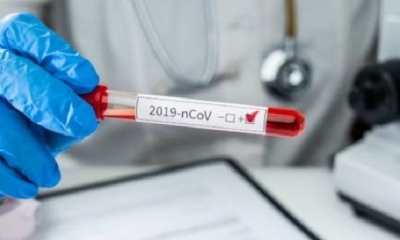 El Ministerio de Salud informó esta noche sobre 184 nuevos casos de Covid-19.