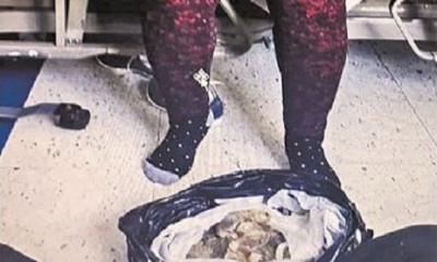 se evidenció mediante una radiografía que en su organismo existían 30 preservativos de látex que contenían droga líquida. Foto: EL DEBER