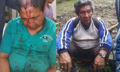 Así quedaron los heridos/Foto. RRSS