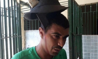 El recluso de una cárcel de Recife herido por el impacto de un machete en la cabeza. Foto: RT