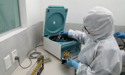 Este jueves Bolivia reportó 1.301 nuevos casos de coronavirus (Covid-19). 