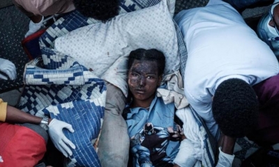 Un residente herido de Togoga, una aldea a unos 20 km al oeste de Mekele. | AFP