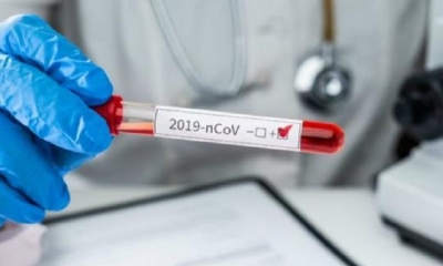 Los nuevos casos del coronavirus a nivel nacional se reportaron en los nueve departamentos del país